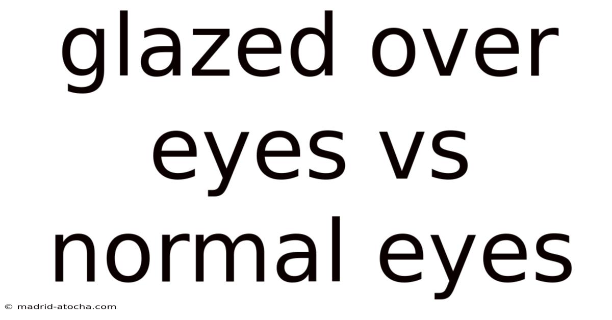 Glazed Over Eyes Vs Normal Eyes