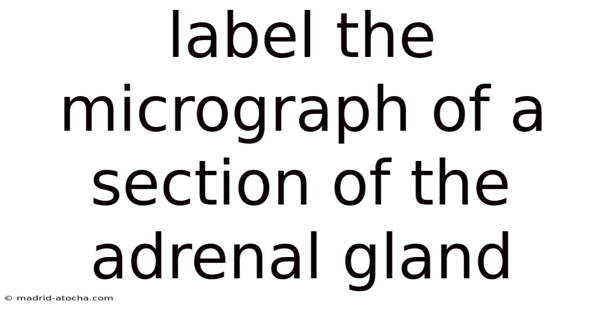 Label The Micrograph Of A Section Of The Adrenal Gland