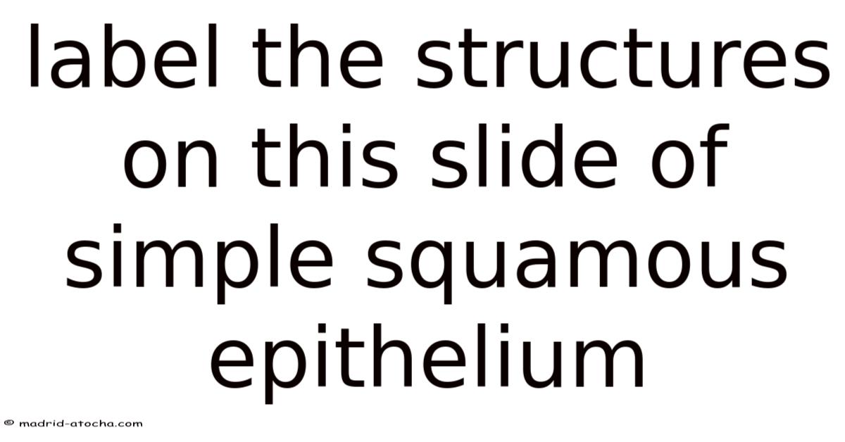 Label The Structures On This Slide Of Simple Squamous Epithelium