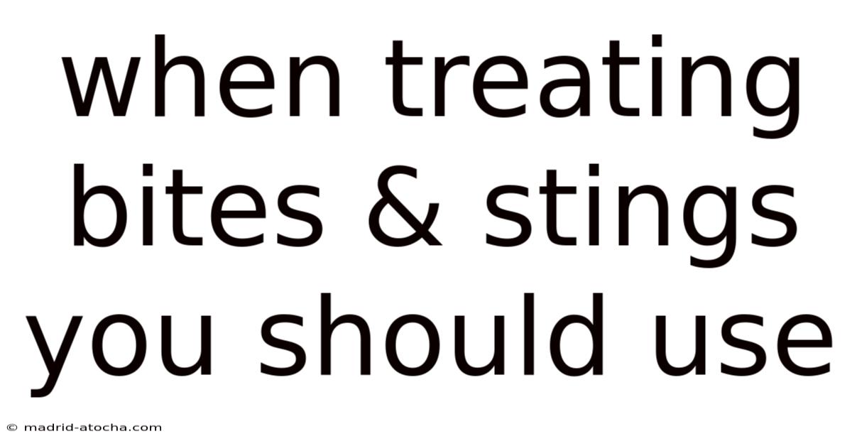 When Treating Bites & Stings You Should Use
