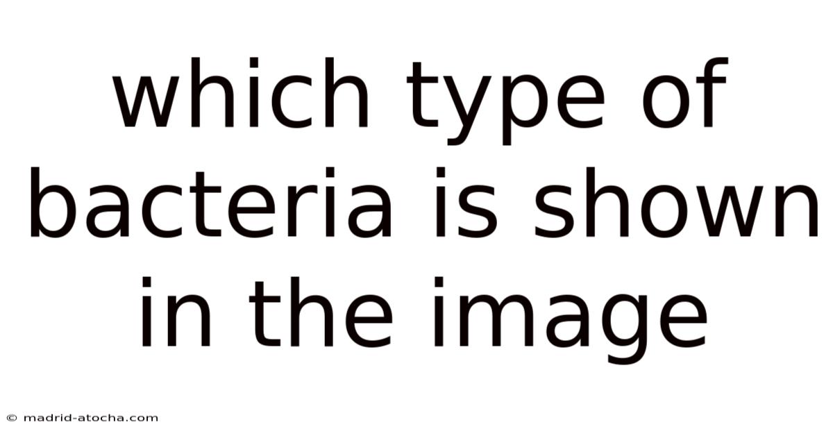 Which Type Of Bacteria Is Shown In The Image